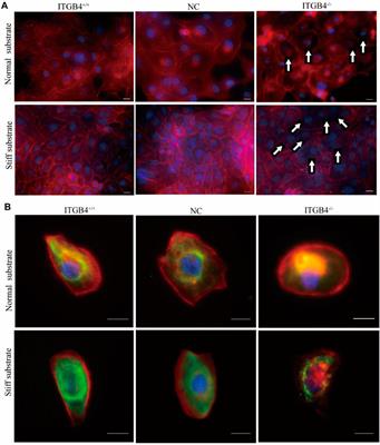 Deficiency of Integrin β4 Results in Increased Lung Tissue Stiffness and Responds to Substrate Stiffness via Modulating RhoA Activity